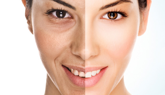 Microdermabrasion In Leeds